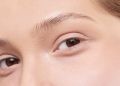 Eyebrow loss during pregnancy