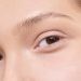 Eyebrow loss during pregnancy